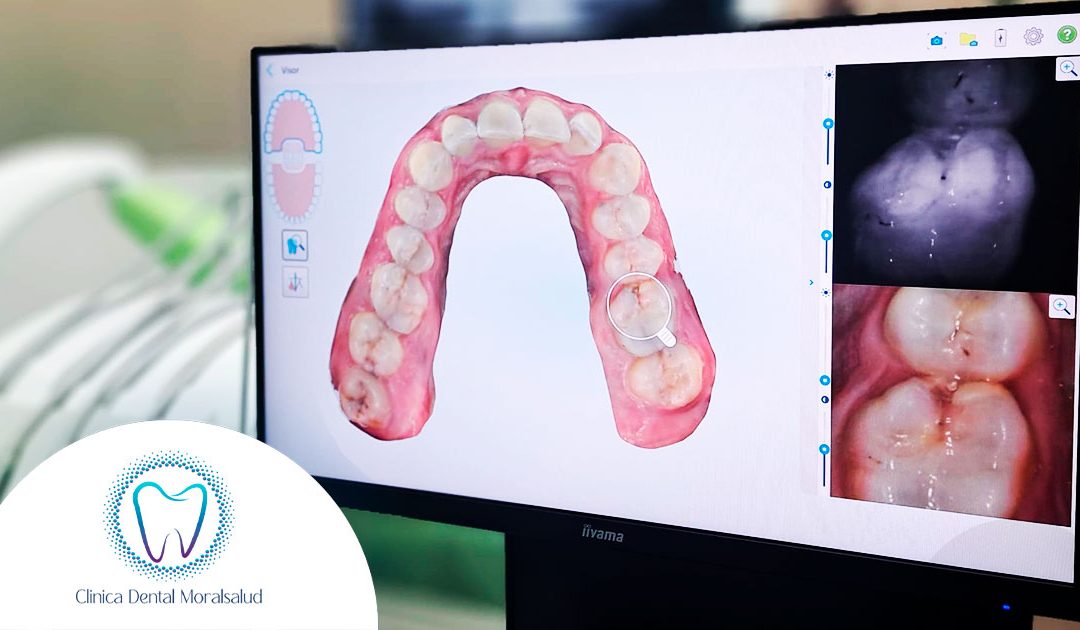 Incorporamos odontología digital con IA en nuestra clínica dental en Moralzarzal