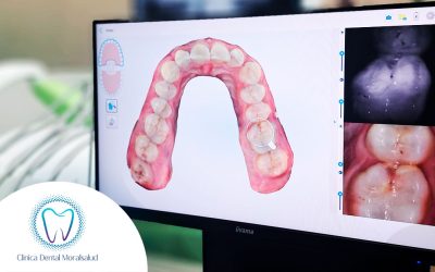 Incorporamos odontología digital con IA en nuestra clínica dental en Moralzarzal